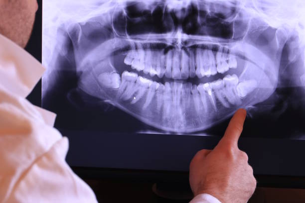 Best Emergency Dental Care for Broken or Chipped Teeth in Dubois, PA